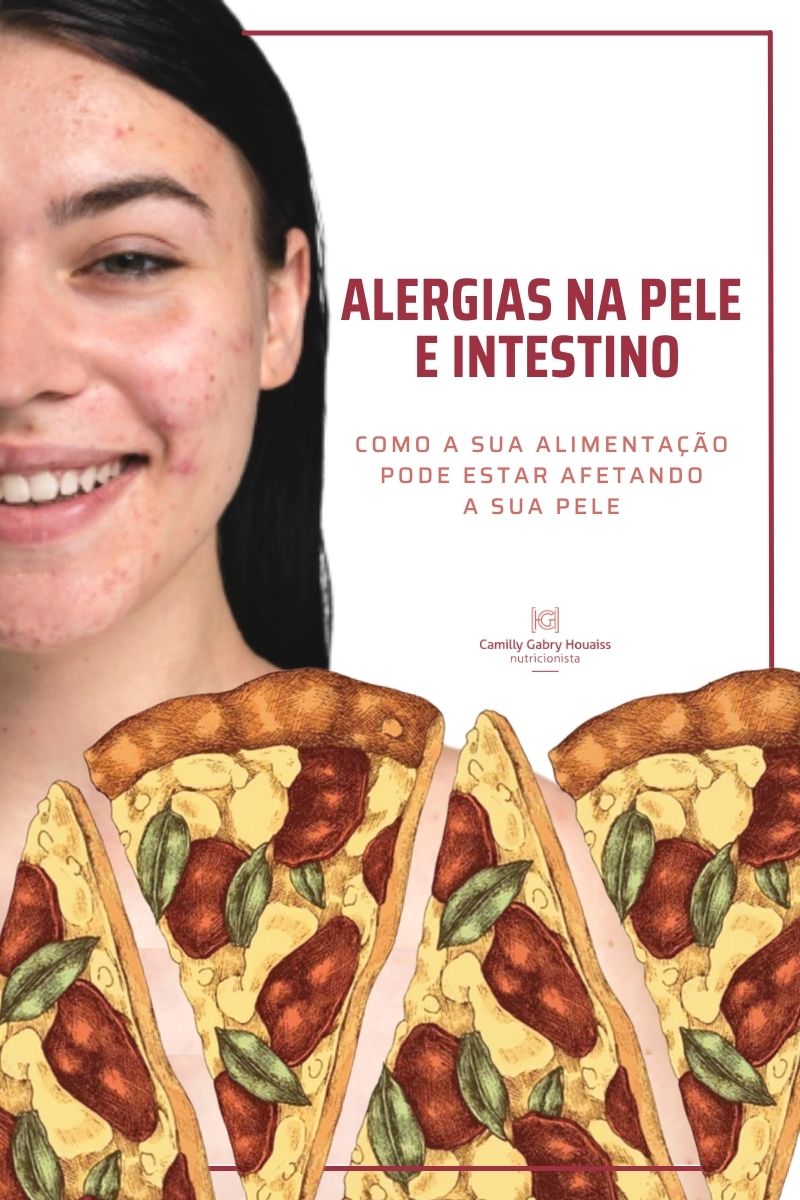 alergia na pele e doença Como a sua alimentação pode estar afetando a sua pele do intestino